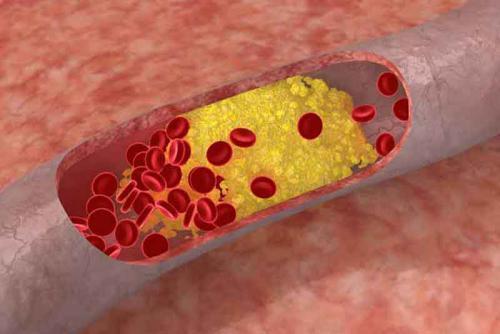 Ważny cholesterol