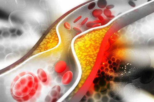 Cholesterol a fitosterole