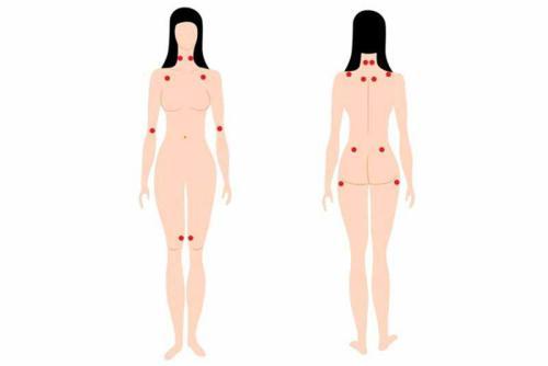 Fibromialgia – jak ją rozpoznać i leczyć