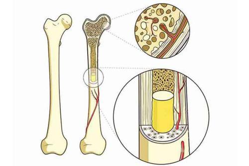 Choroby kości, ich przyczyny i objawy