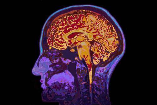 Biopsja mózgu z zastosowaniem systemu Navigus