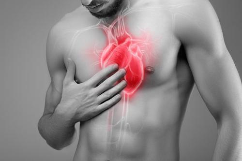 Zawał serca – objawy, czynniki ryzyka