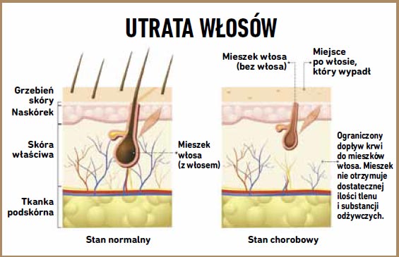 Włosy