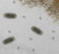 Groźna E. coli, czyli pałeczka okrężnicy