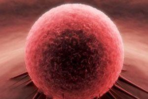Poznano przyczynę oporności raka jajnika na chemioterapię