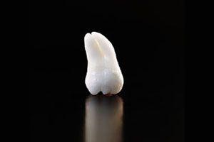 Zęby mądrości – czy i do czego są potrzebne