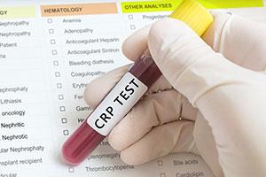 CRP – marker infekcji