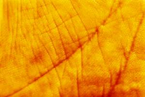 Łojotokowe zapalenie skóry – tajemnice żółtych łusek