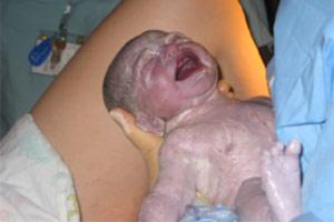 Rola anestezjologa niedoceniona podczas porodu