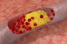 Cholesterol egzogenny i endogenny