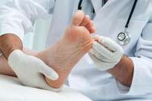Grzybice stóp i paznokci – objawy, leczenie, profilaktyka