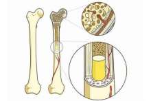 Choroby kości, ich przyczyny i objawy