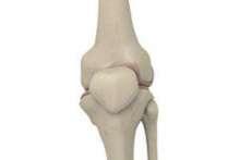 Ortopedia. Co szkodzi naszym kościom