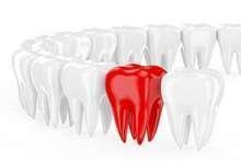 Utrata zębów ma związek ze spadkiem sprawności ciała i umysłu